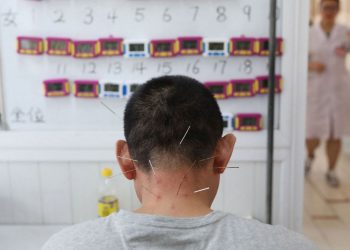 Les acupuncteurs réagissent avec indignation aux déclarations critiques de Vandenbroucke sur leur pratique – RTBF Actus