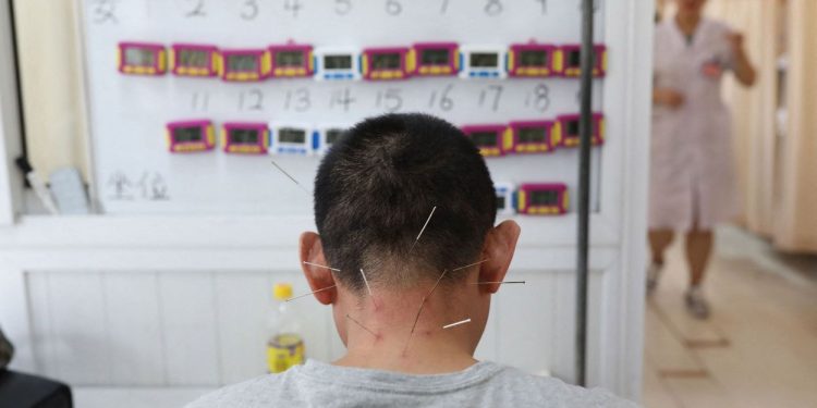 Les acupuncteurs réagissent avec indignation aux déclarations critiques de Vandenbroucke sur leur pratique – RTBF Actus